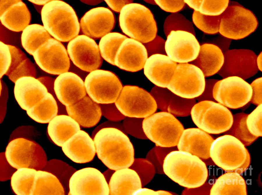streptococcus lactis microscopic