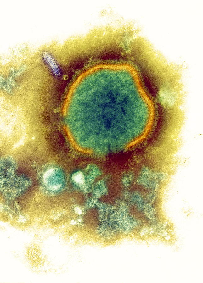 Measles Virus Photograph - Measles Virus, Tem #1 by Nibsc