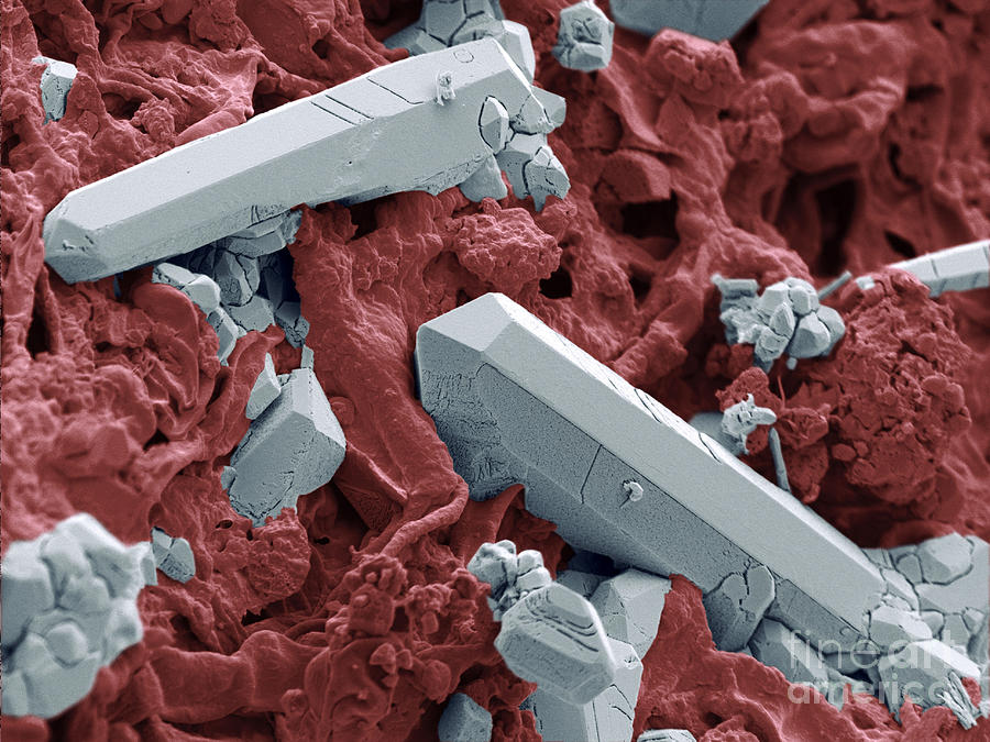 Natural Statin Crystals In Red Yeast Photograph by Scimat Fine Art