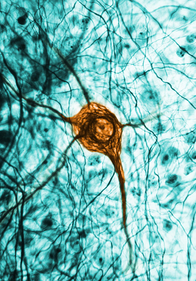 Neuron, Tem #1 Photograph by Science Source