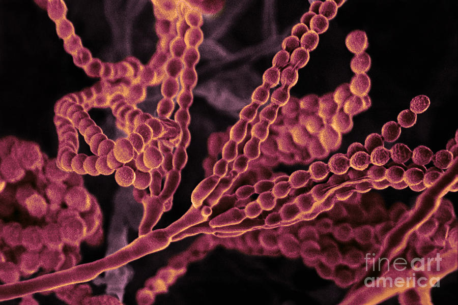 Penicillium With Spores #1 Photograph by Scimat