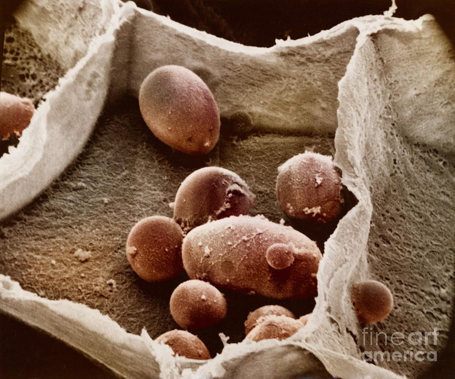 Potato Cell With Starch Granules #1 Photograph by Omikron