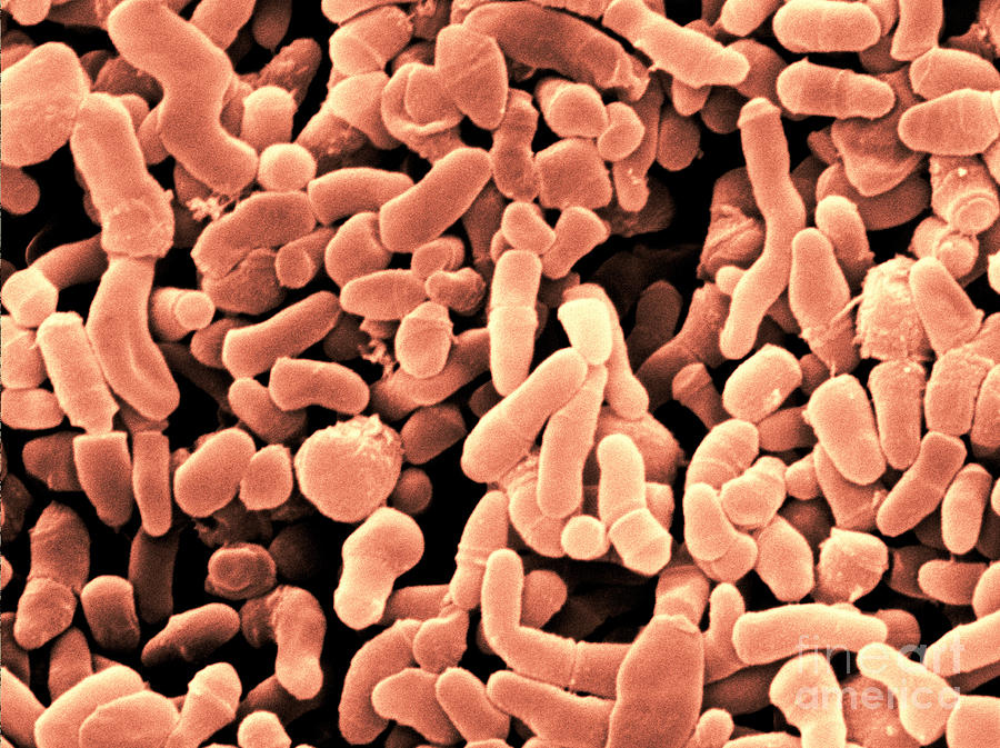Propionibacterium Acnes Bacteria, Sem #1 Photograph by Scimat