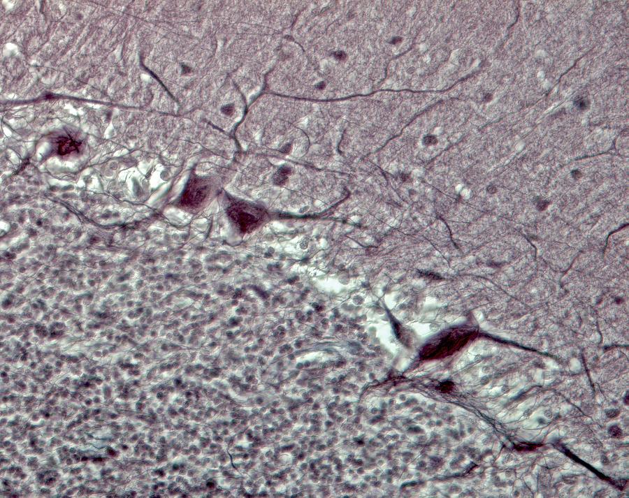 Purkinje Cell Photograph - Purkinje Neurons, Light Micrograph #1 by Robert Markus