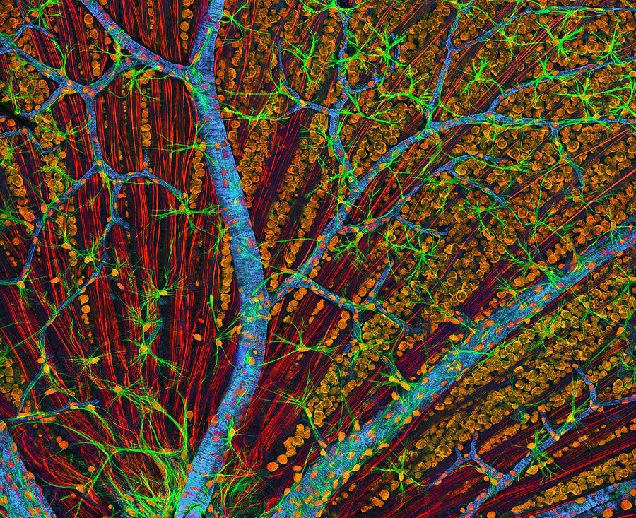 Nerve Cell Photograph - Retina Blood Vessels And Nerve Cells #1 by Thomas Deerinck, Ncmir