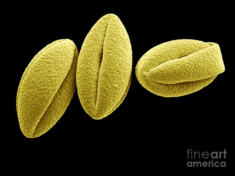 Rhubarb Pollen, Sem #1 Photograph by Scimat