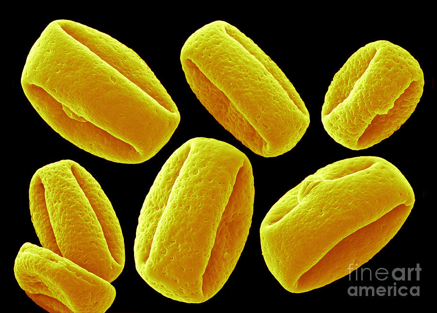 Science Photograph - Schefflera Actinophylla Pollen, Sem #1 by Scimat