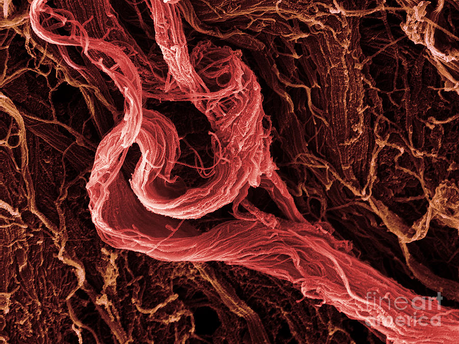 Sem Human Muscle Tissue #1 Photograph by Ted Kinsman