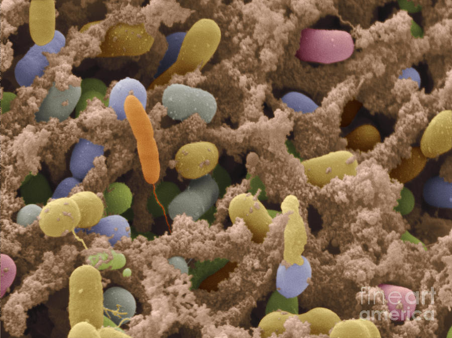 Sem Of Bacteria On Chicken Photograph by Scimat - Fine Art America