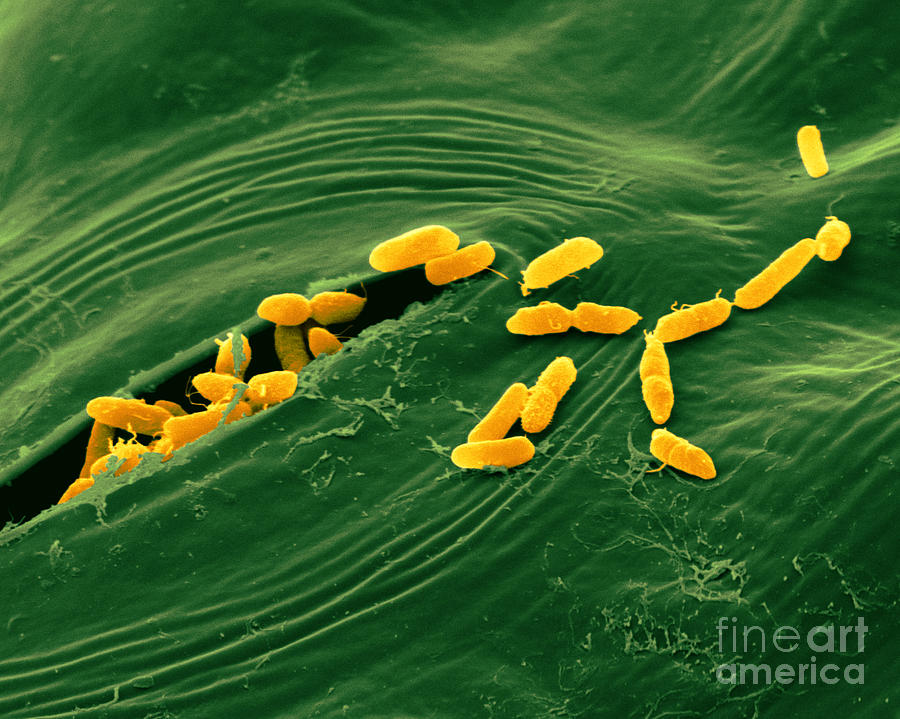 Sem Of E. Coli Bacteria On Lettuce #1 Photograph by Scimat