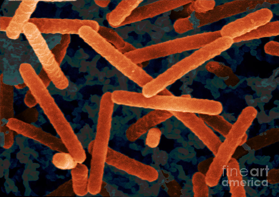 Sem Of Lactobacillus Acidophilus #1 Photograph by Scimat