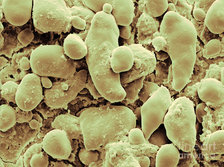 Sem Of Starch Granules #1 Photograph by Scimat