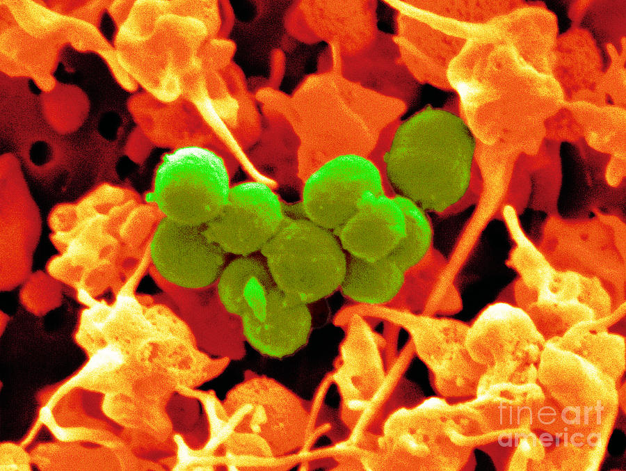 Staphylococcus Epidermidis Bacteria #1 Photograph by Scimat
