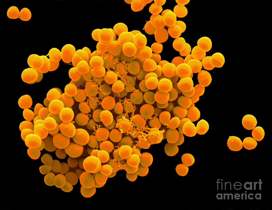 Staphylococcus Epidermidis Photograph By Scimat Pixels