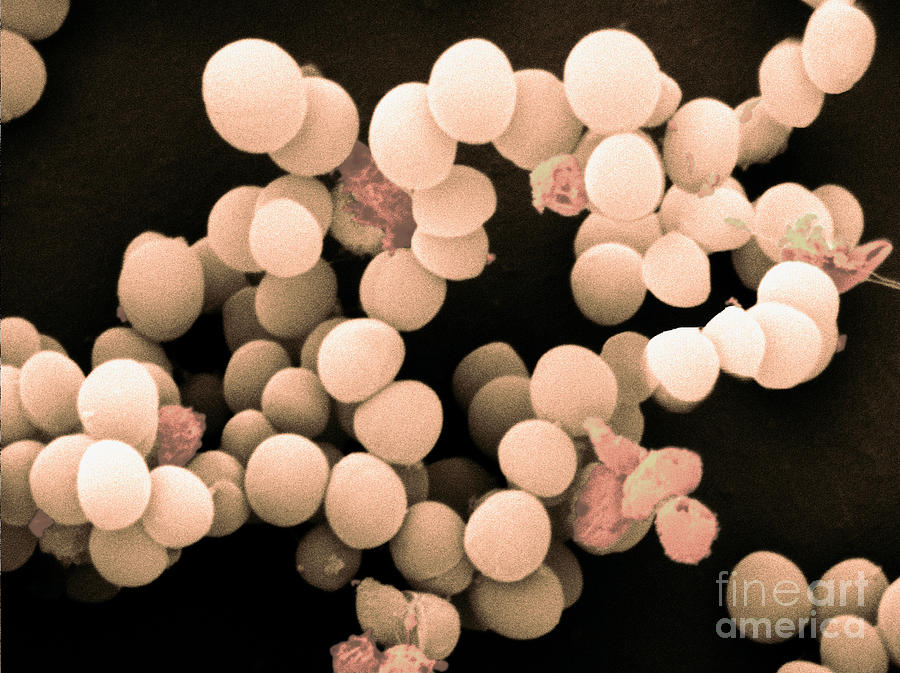 Staphylococcus Saccharolyticus #1 Photograph by Scimat