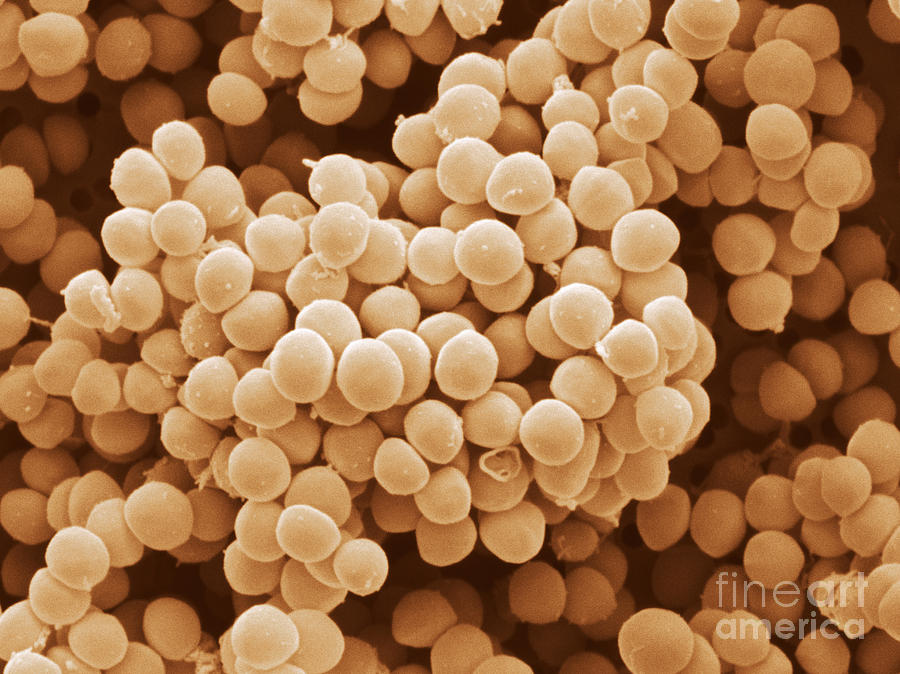 staphylococcus-saprophyticus-photograph-by-scimat