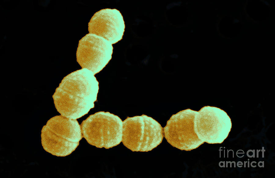 Streptococcus Cremoris #1 Photograph by Scimat