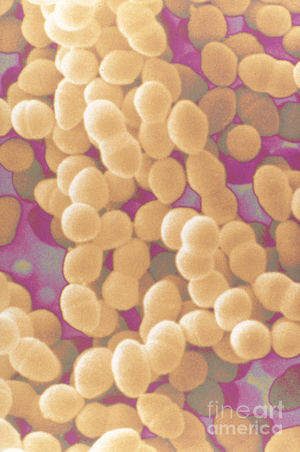 Streptococcus Faecalis #1 Photograph by Scimat