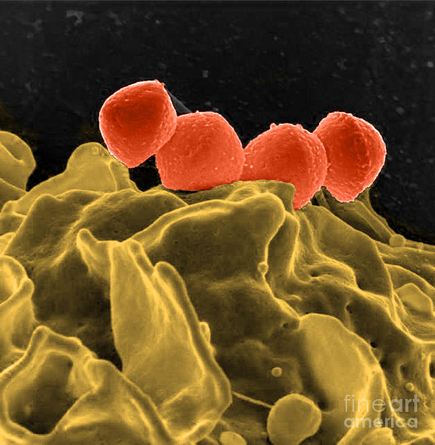 Streptococcus Pyogenes Bacteria, Sem #1 Photograph by Science Source