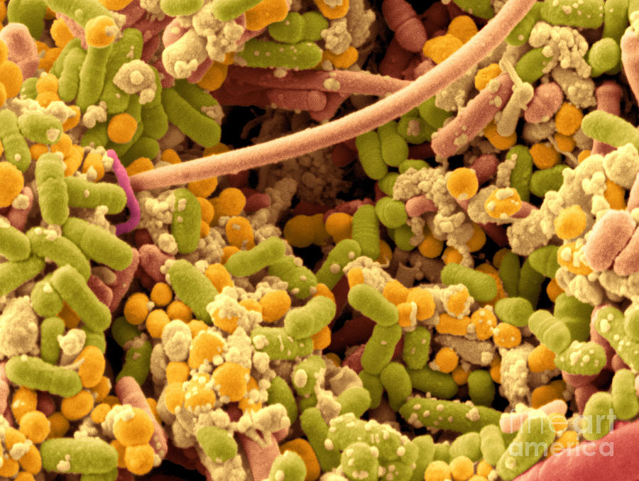 Streptococcus Pyogenes #1 Photograph by Scimat