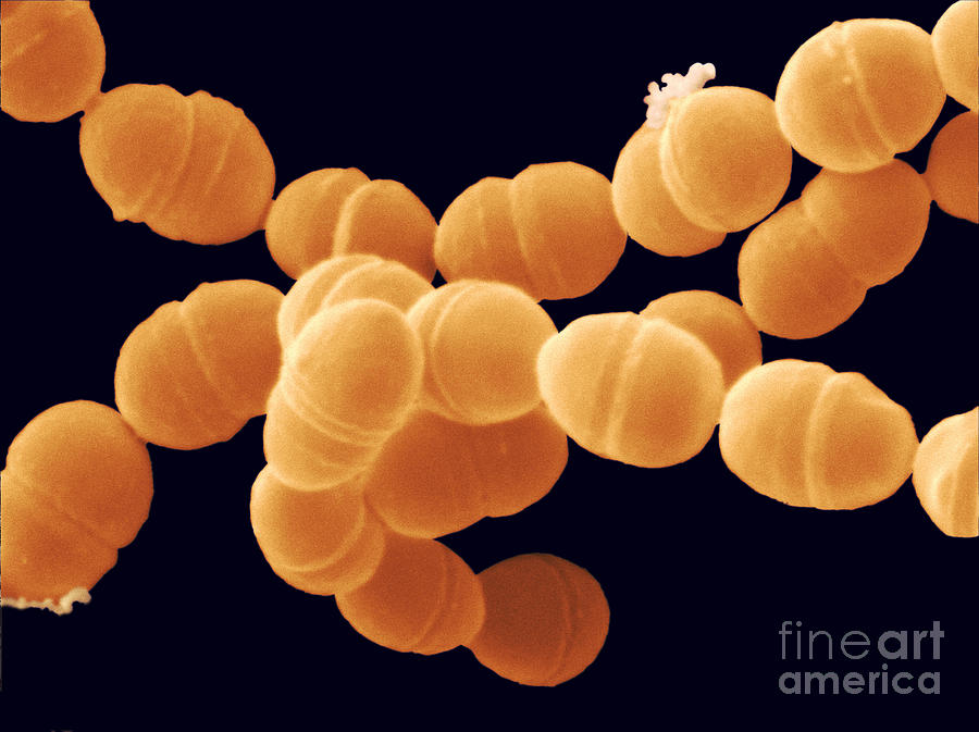 Streptococcus Thermophilus Bacteria Sem #1 Photograph by Scimat