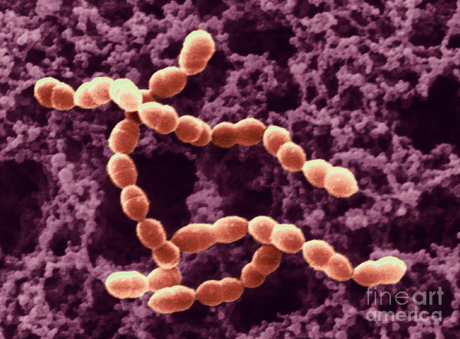 Streptococcus Thermophilus In Yogurt #1 Photograph by Scimat