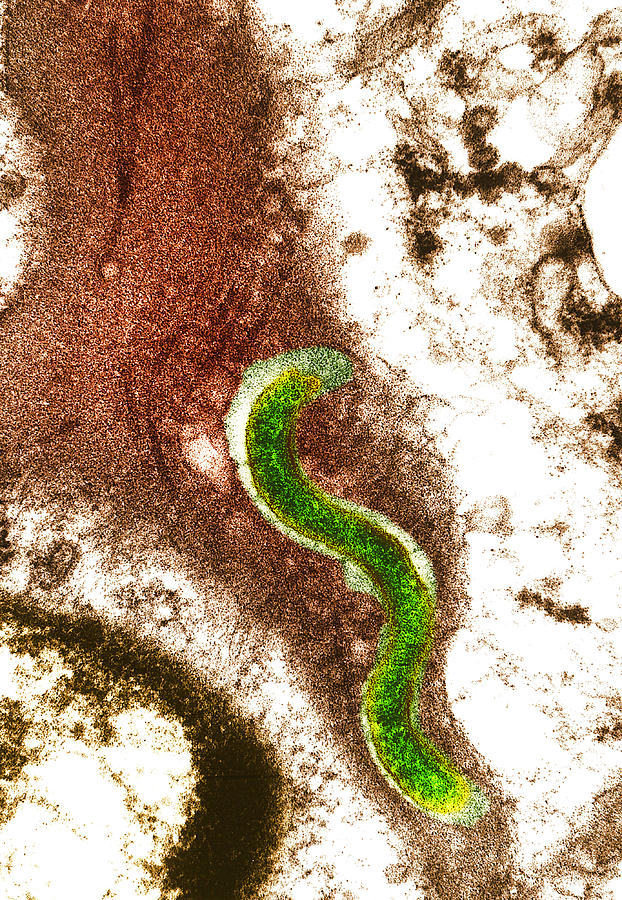 Syphilis Photograph - Syphilis Bacterium (treponema Pallidum) #1 by Biomedical Imaging Unit, Southampton General Hospital
