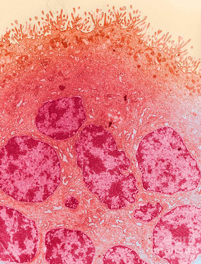 Histology Photograph - Tem Of Placenta #1 by David M. Phillips