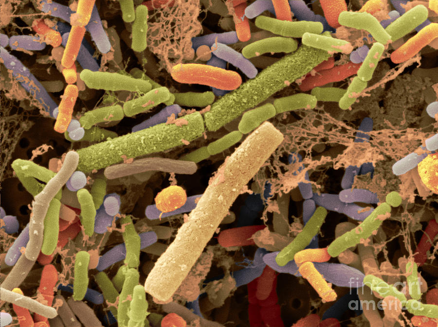 Toddlers Feces With Bifidobacteria, Sem #1 Photograph by Scimat