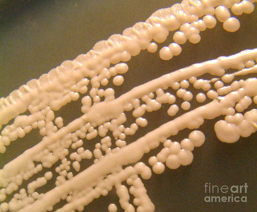 Yeast #1 Photograph by Scimat
