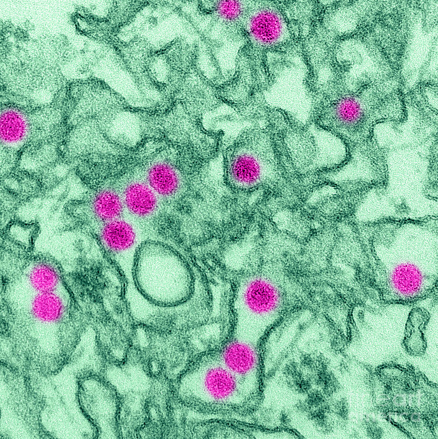 Zika Virus, Tem #1 Photograph by Science Source