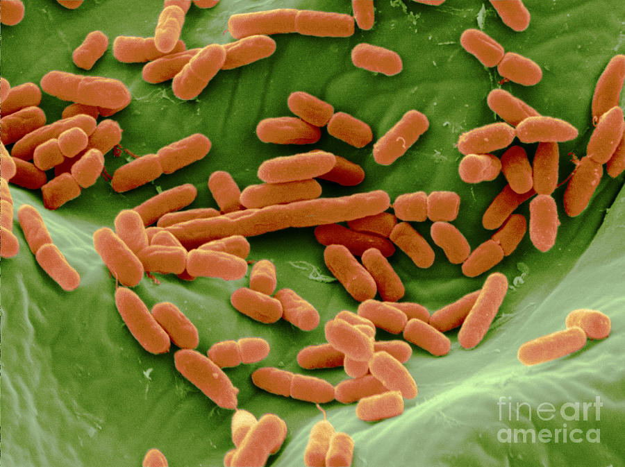 Sem Of E. Coli Bacteria On Lettuce #10 Photograph by Scimat