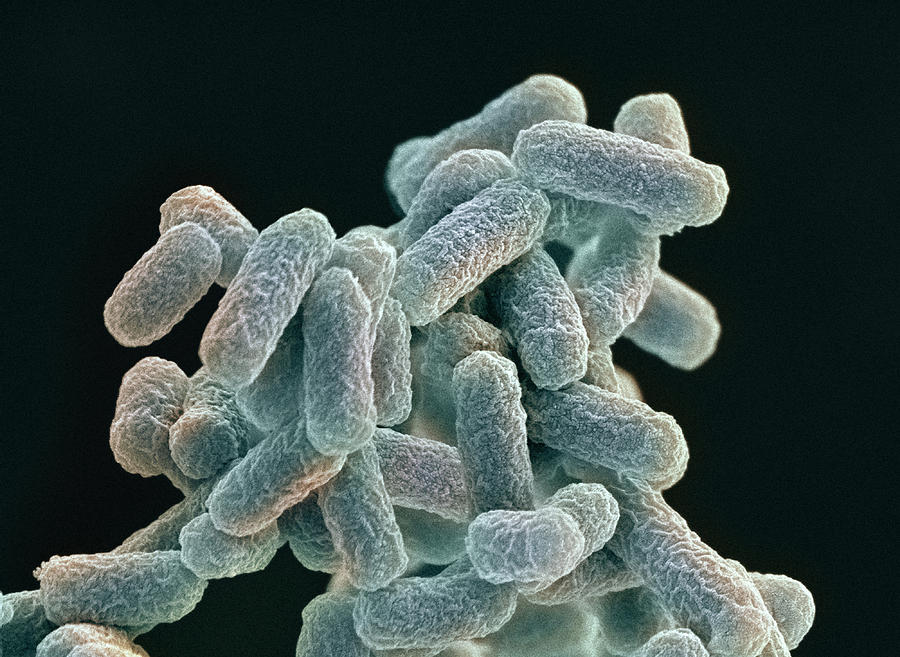 Escherichia Coli Photograph - E. Coli Bacteria, Sem #14 by Steve Gschmeissner