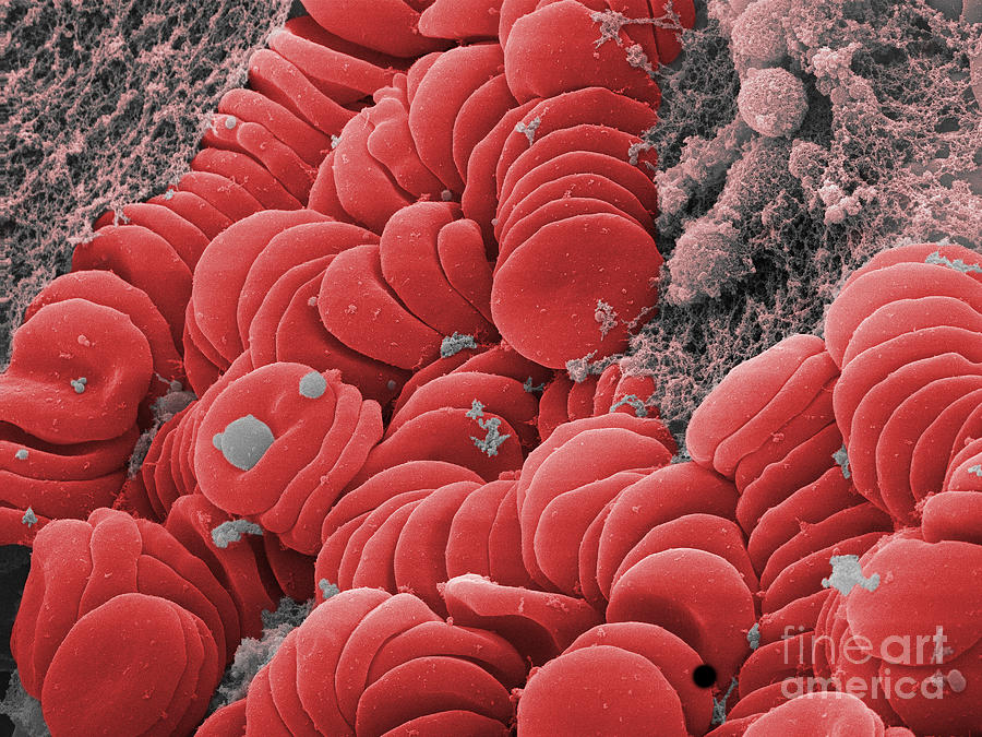 Human Red Blood Cells, Sem #14 Photograph by Ted Kinsman