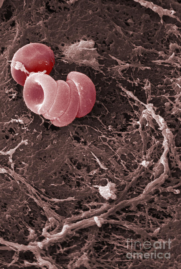 Human Red Blood Cells, Sem #15 Photograph by Ted Kinsman