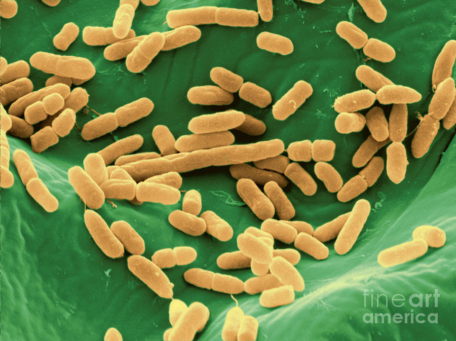 Sem Of E. Coli Bacteria On Lettuce #16 Photograph by Scimat