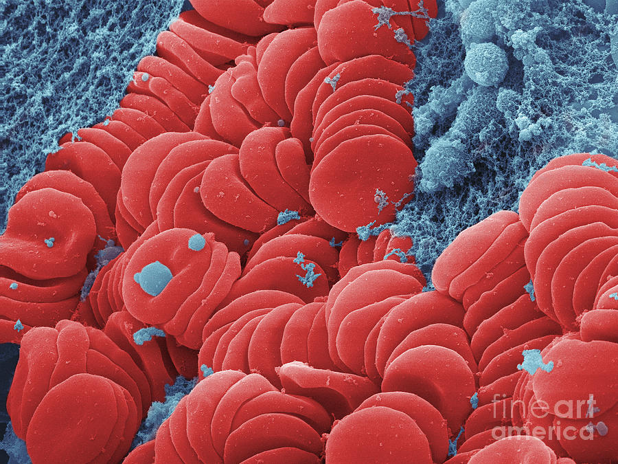 Human Red Blood Cells, Sem #17 Photograph by Ted Kinsman