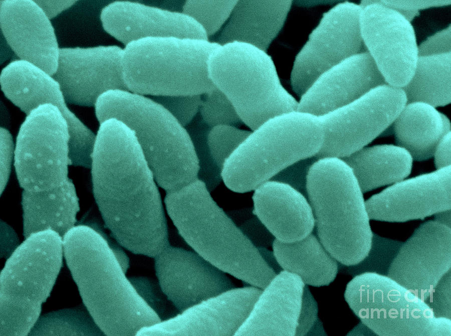 Acetobacter Photograph - Acetobacter Aceti Bacteria by Scimat