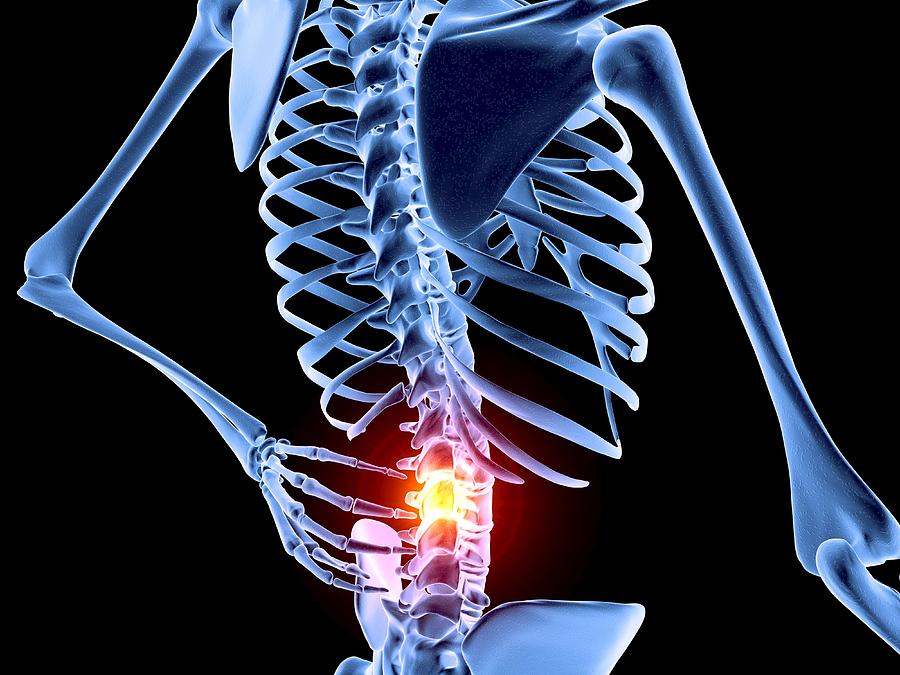 Skeleton Photograph - Back Pain #2 by Pasieka