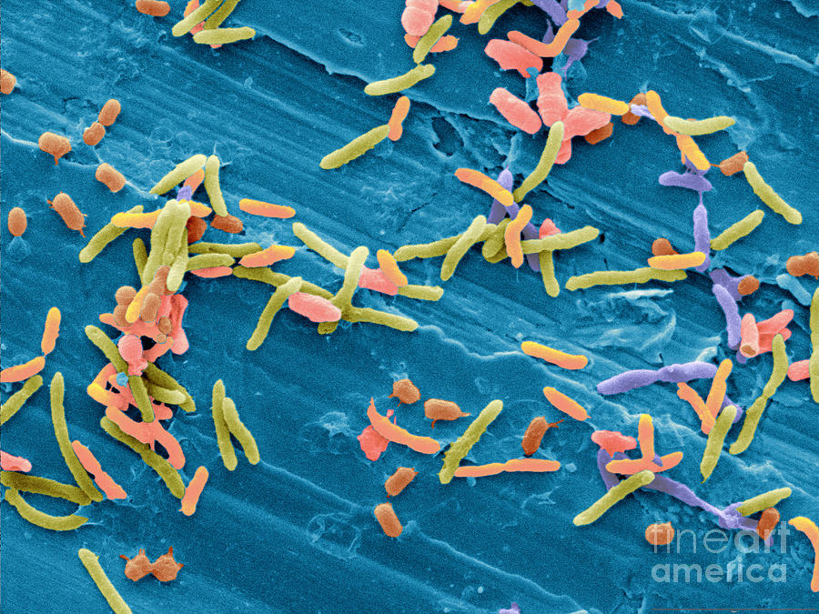 Bacteria From Raw Chicken Meat, Sem #2 Photograph by Scimat