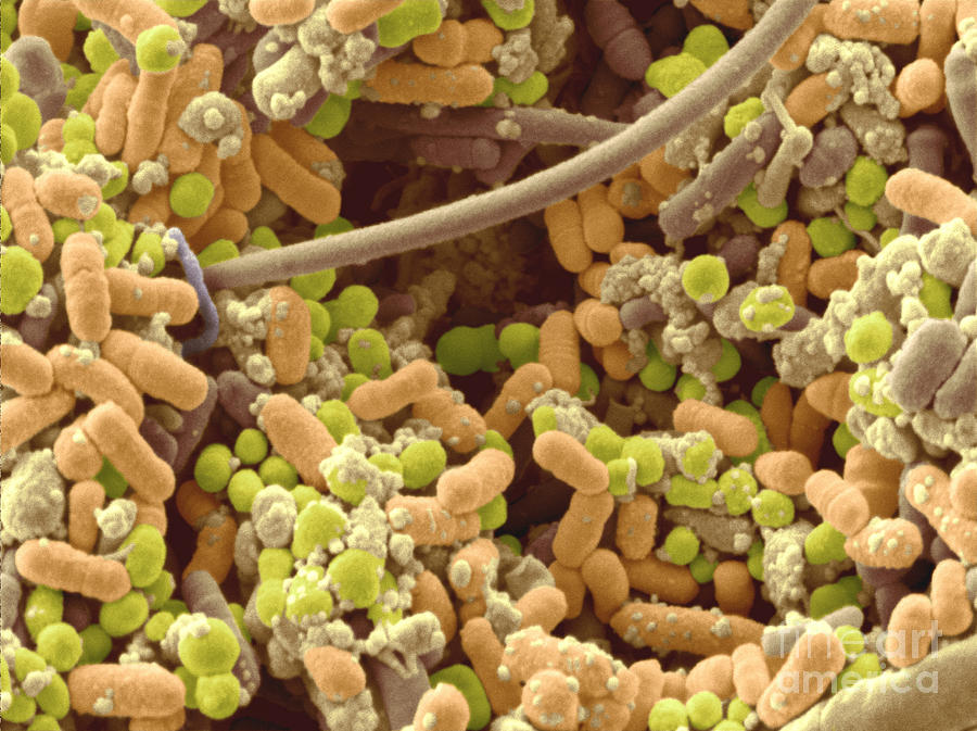 Bacteria In Human Tonsil Pus, Sem #2 Photograph by Scimat