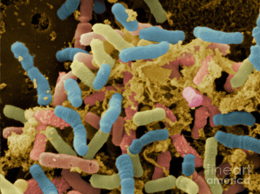 Bacterial Microflora In The Stool #2 Photograph by Scimat