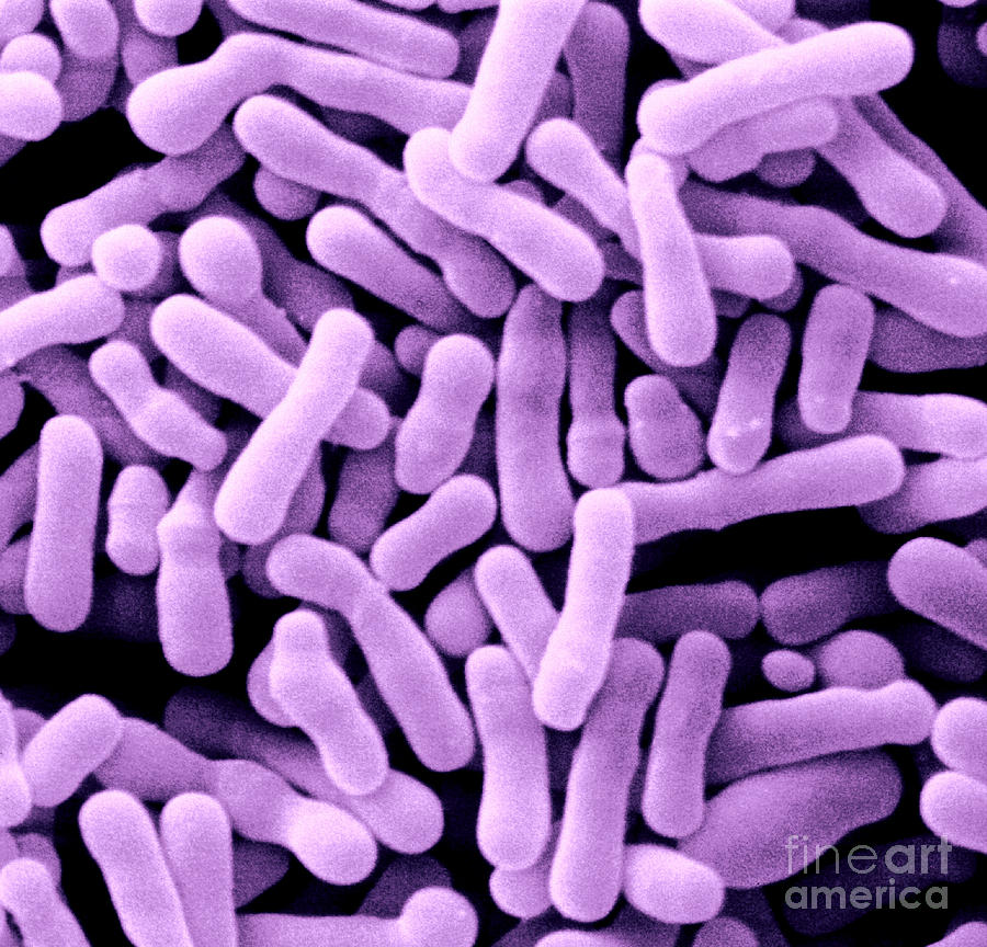 Bifidobacterium Animalis #2 Photograph by Scimat