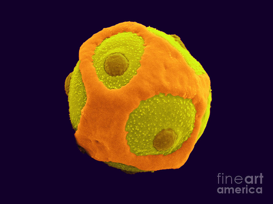 Blackcurrant Pollen, Sem #2 Photograph by Scimat