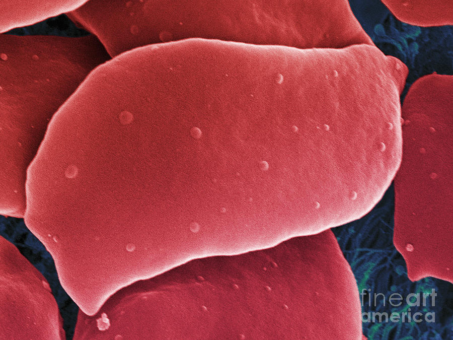 Blood Platelets, Sem #2 Photograph by Ted Kinsman