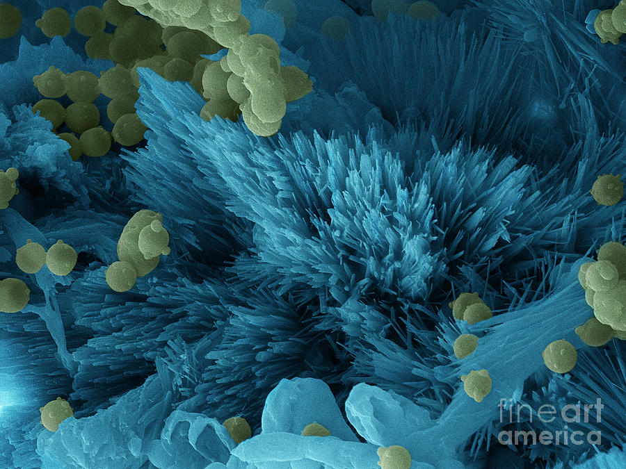 Cheese Photograph - Blue Cheese, Sem #3 by Ted Kinsman