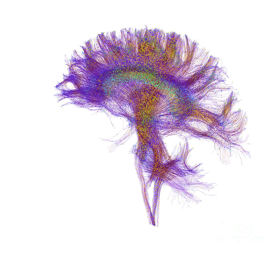 Brain, Fiber Tractography Image #2 Photograph by Scott Camazine