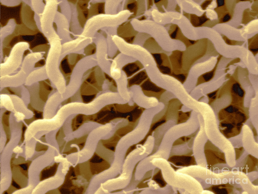 Campylobacter Jejuni #2 Photograph by Scimat