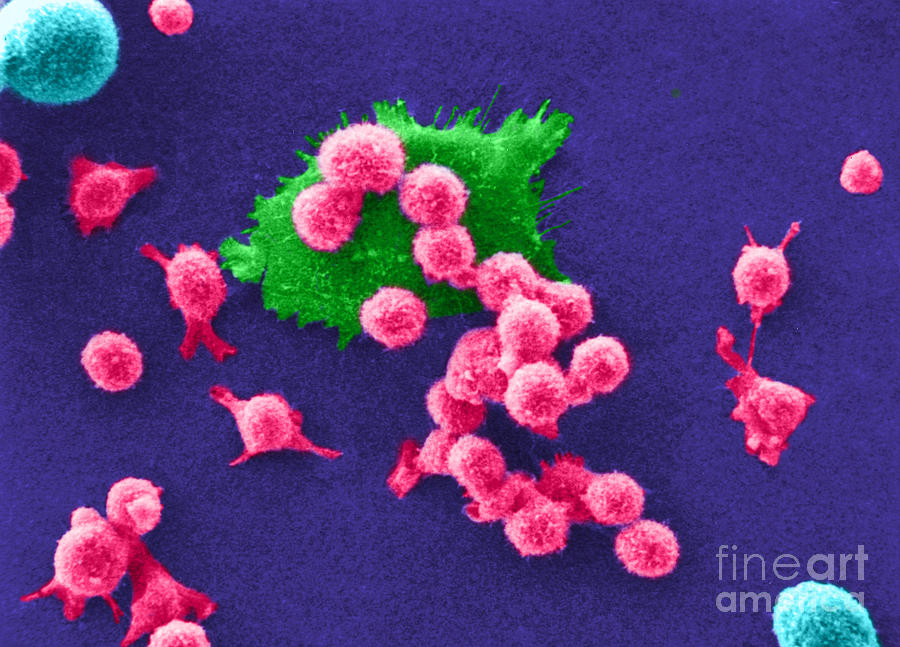 Scanning Electron Micrograph Photograph - Cancer Cell Death, Sem 2 Of 6 #2 by Science Source