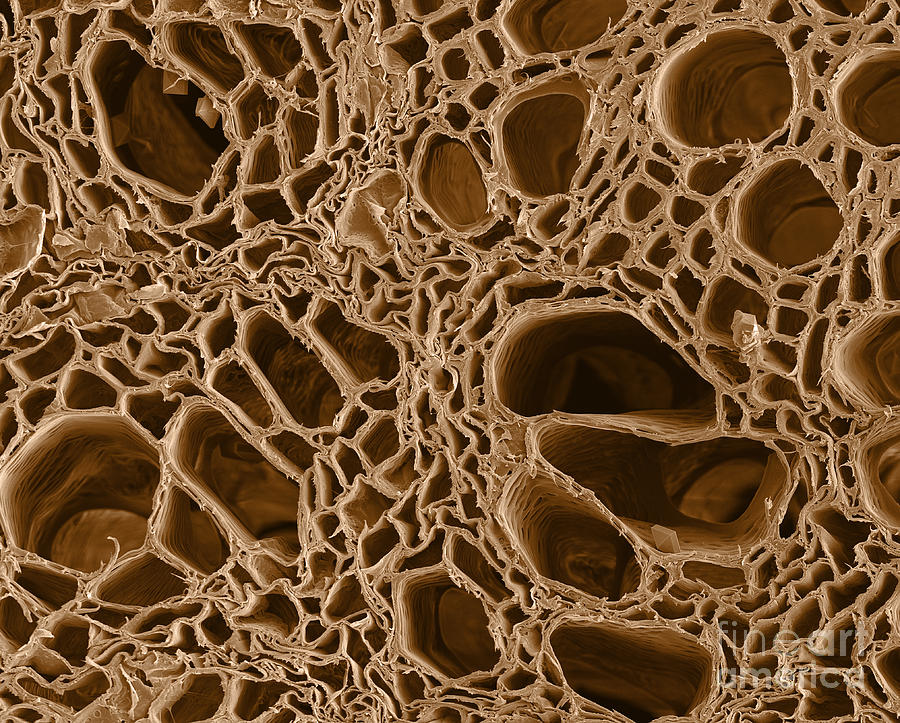 Cannabis Root, SEM #2 Photograph by Ted Kinsman